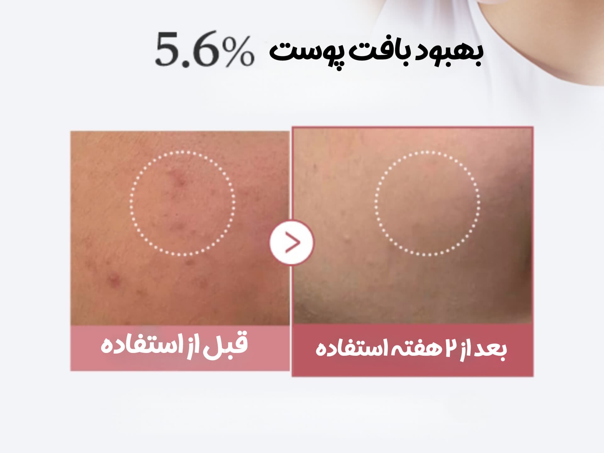 ست سرم یک روزه PDRN صورتی مدی کیوب — تصویر ۵