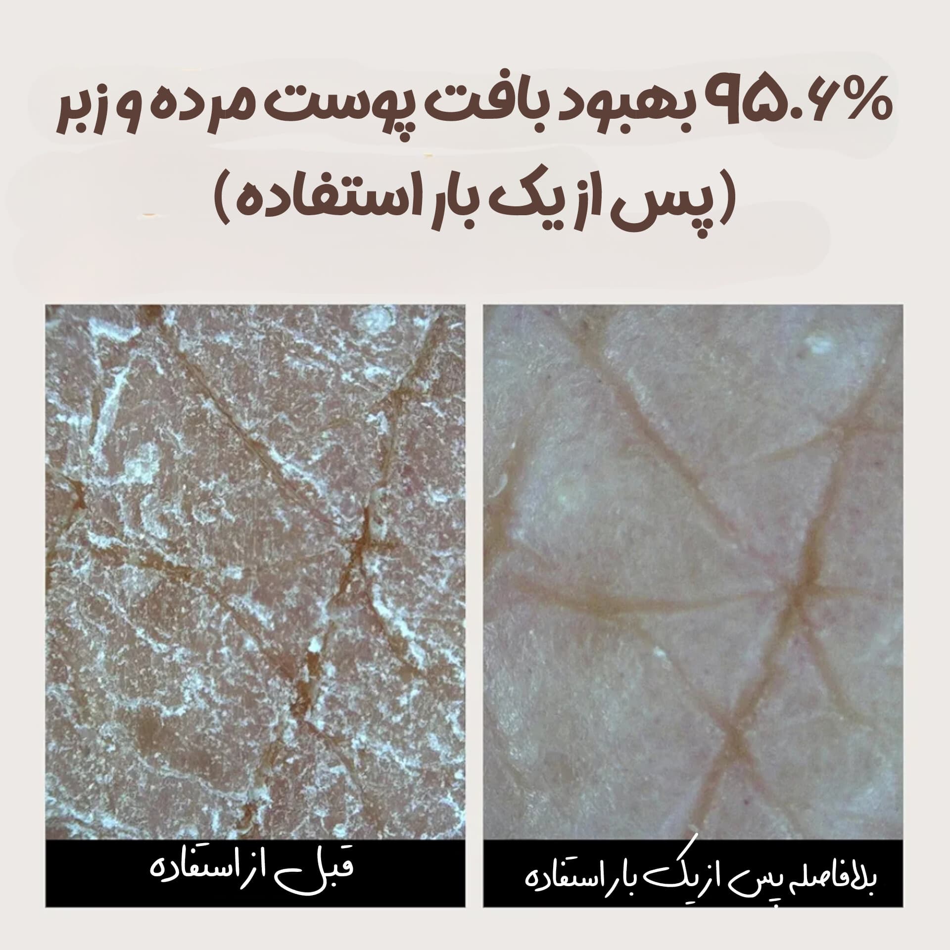 سرم روشن کننده ویتامین سی و گالاکتومایسس سام بای می — تصویر ۸