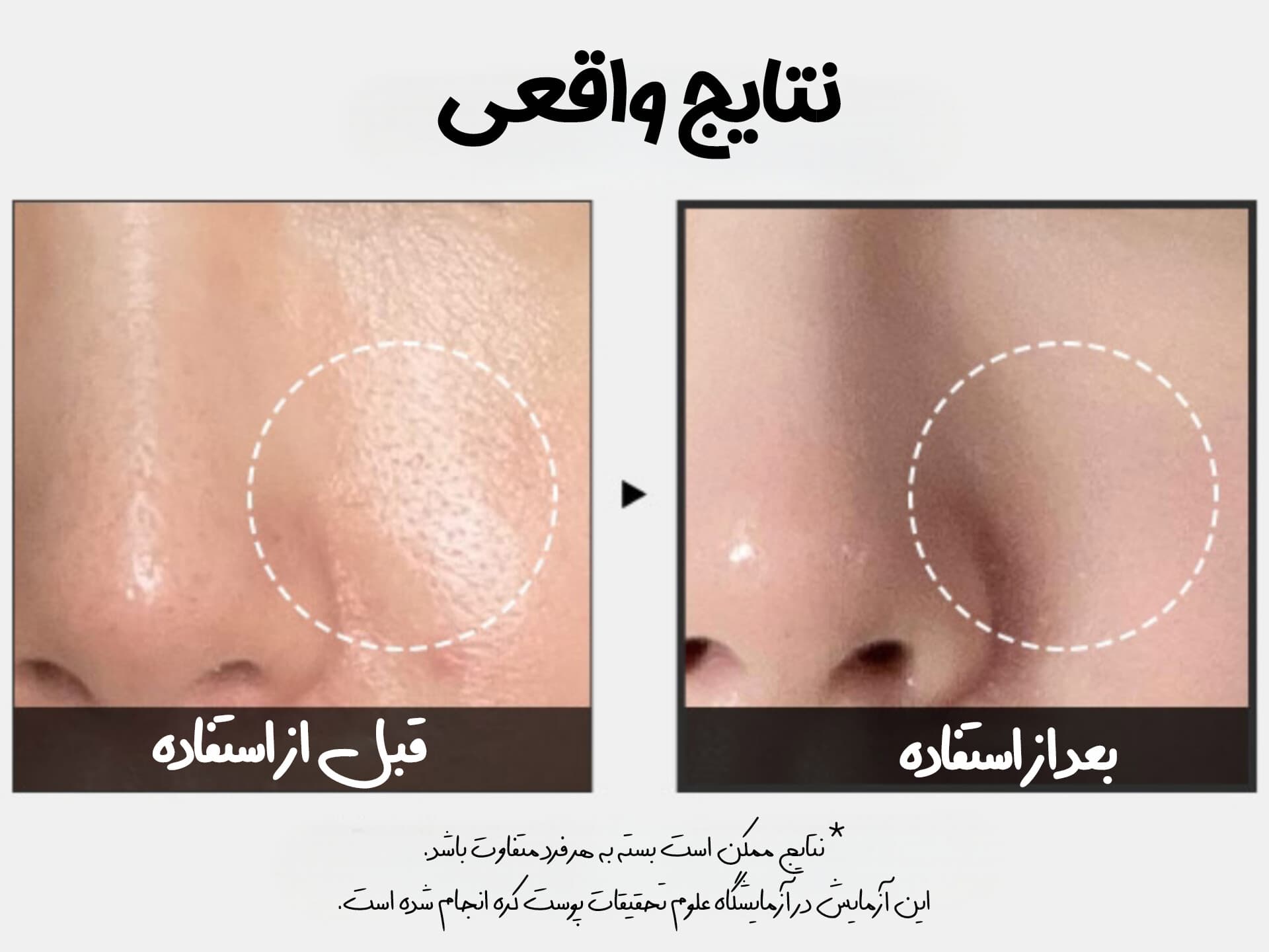 پد تونر لایه بردار ملایم و کنترل منافذ مدی کیوب — تصویر ۴