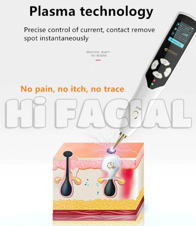 دستگاه پلاسما پن فیوژن اورجینال PAA اصل — تصویر ۲