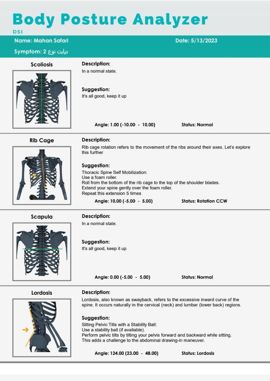 Body Posture Analyzer — تصویر ۵
