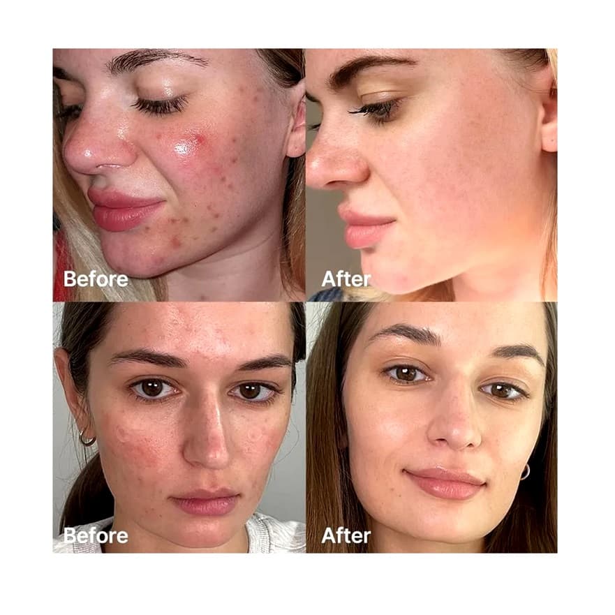 کرم کپسولی ترانگزامیک اسید و نیاسینامید مدی کیوب Medicube TXA Niacinamide Capsule Cream — تصویر ۴