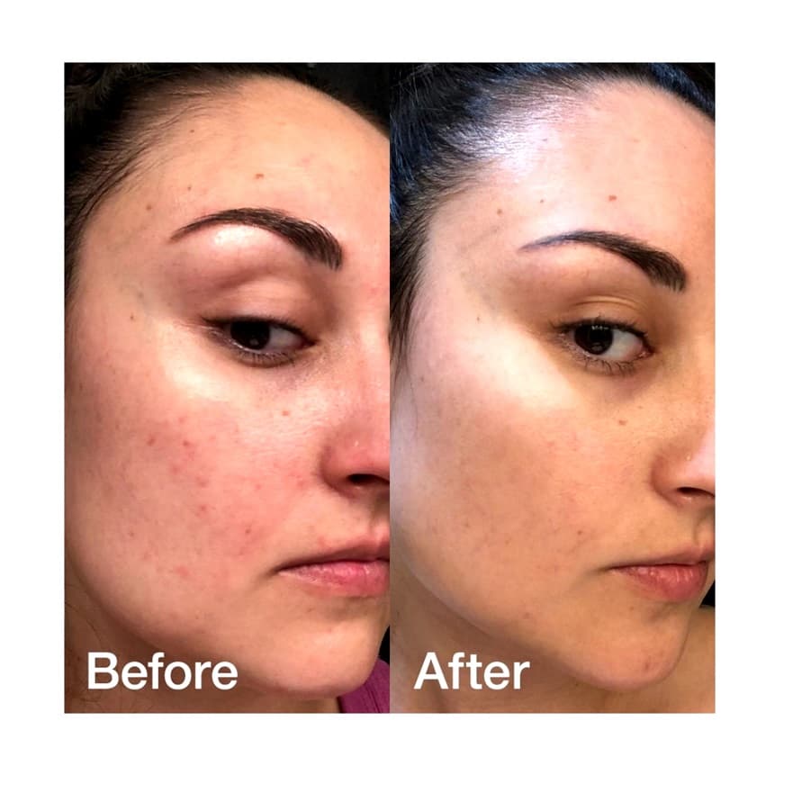 کرم کپسولی ترانگزامیک اسید و نیاسینامید مدی کیوب Medicube TXA Niacinamide Capsule Cream — تصویر ۵