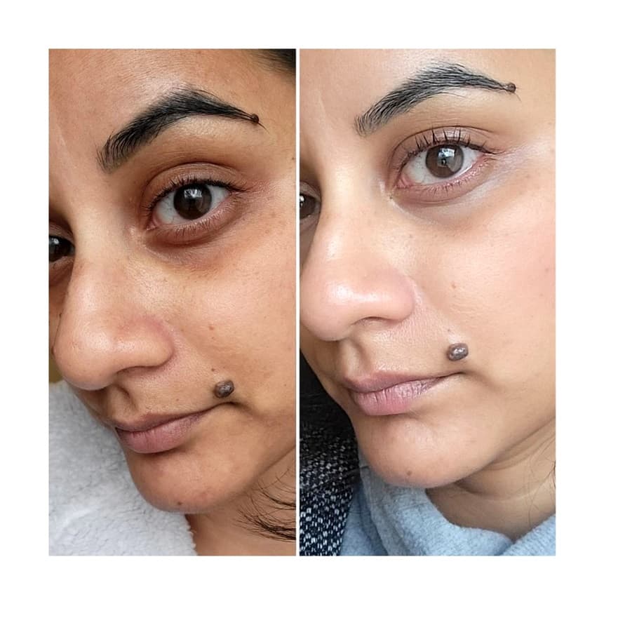 سرم ضد چروک و حجم دهنده باکوچیول اکوال بری Eqqualberry Bakuchiol Plumping Serum — تصویر ۷