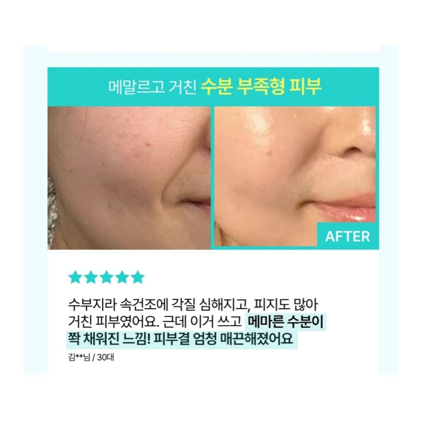 کرم مرطوب کننده و آبرسان PDRN و هیالورونیک اسید آنوا Anua PDRN Hyaluronic Acid 100 Moisturizing Cream — تصویر ۳