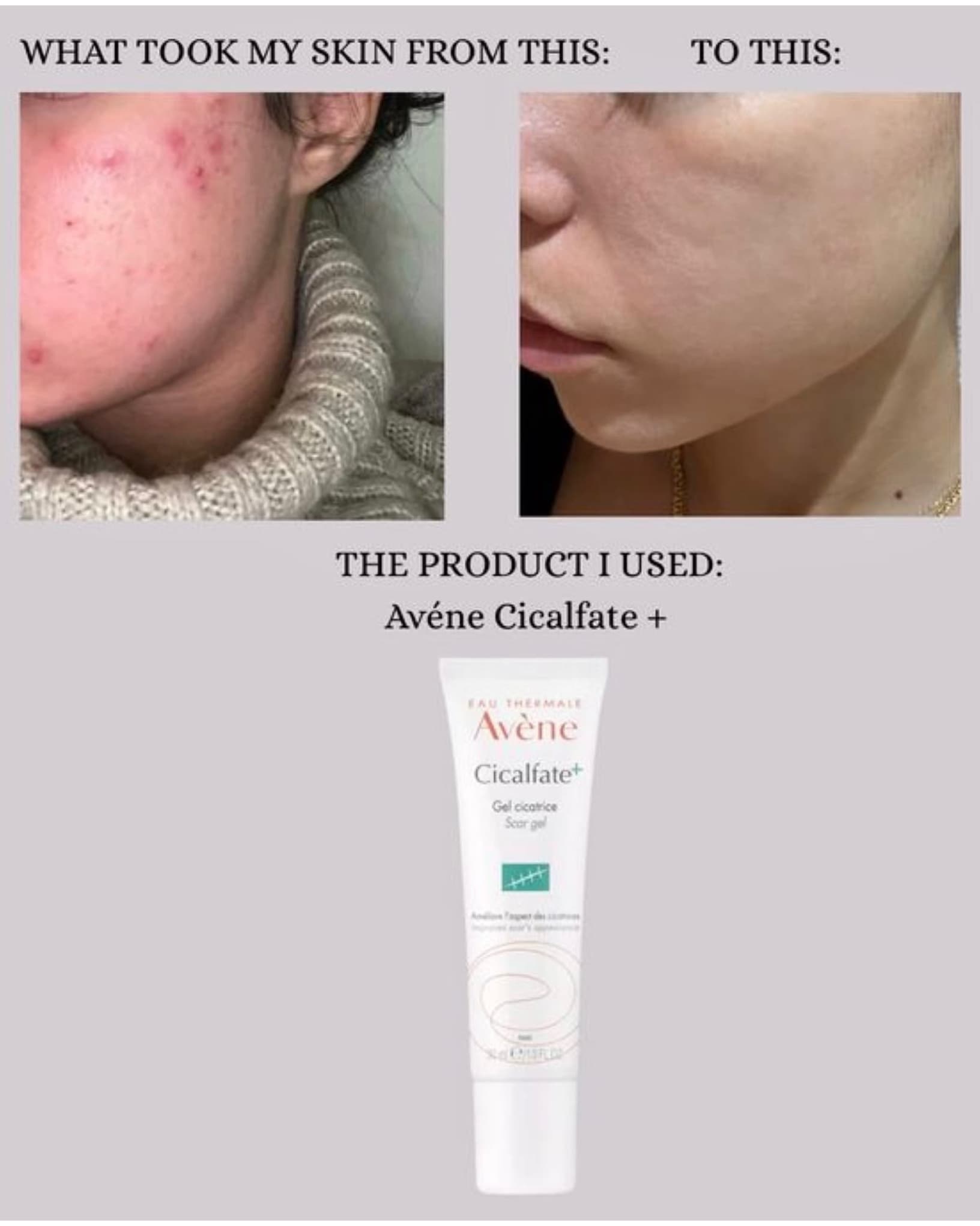 ترمیم کننده اون مدل سیکالیفت پلاس اورجینال- Avene-40ml — تصویر ۴