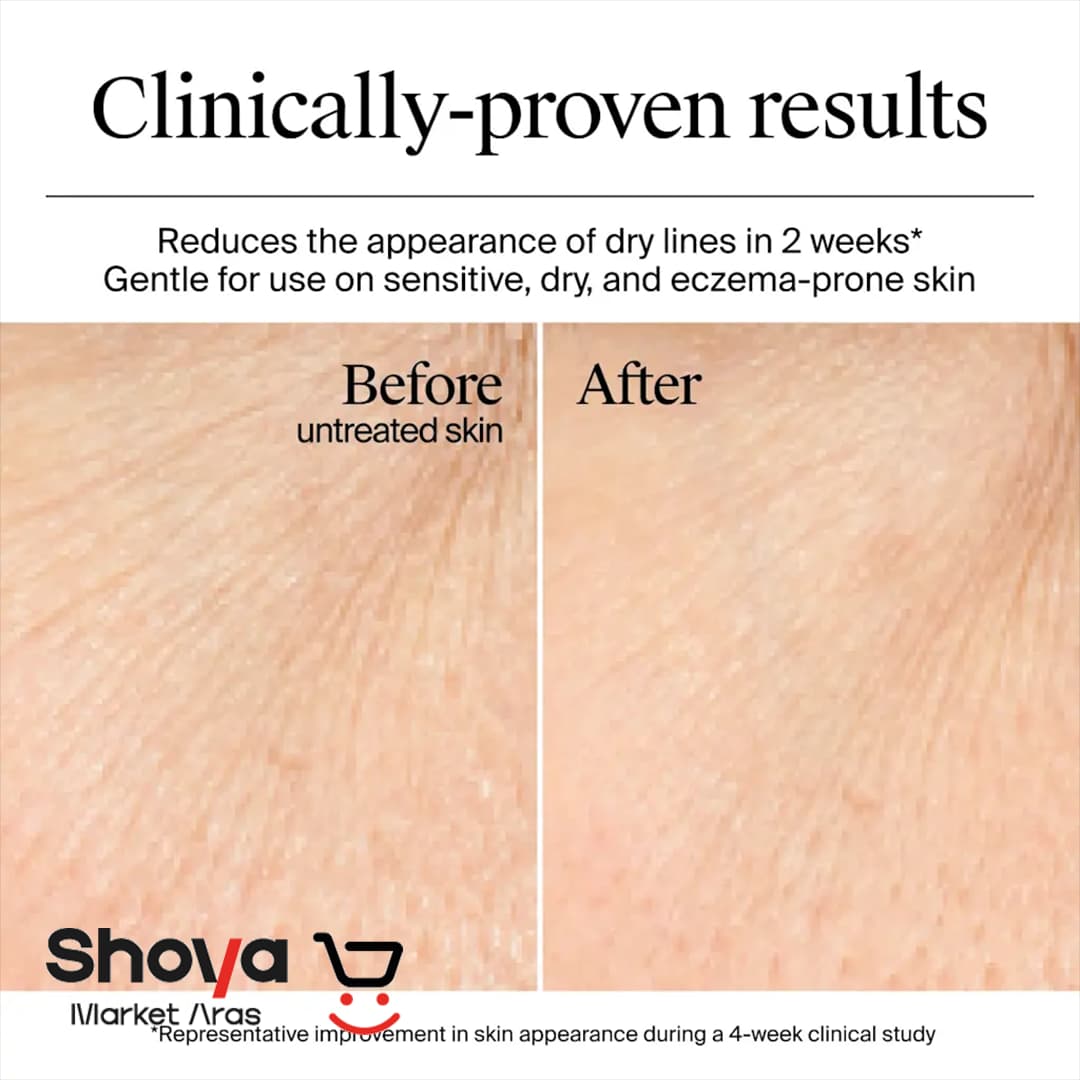 ژل آبرسان نیتروژنا Neutrogena سری Hydro Boost مدل بمب آبرسان مناسب پوست های معمولی و مختلط حجم 50 میلی‌لیتر — تصویر ۷