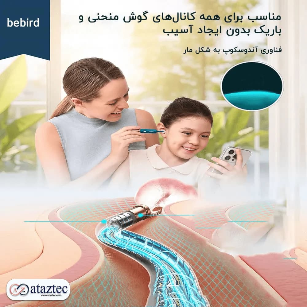 گوش پاک کن تصویری شیائومی مدل Bebird D39R | دوربین 4K، اتصال WiFi و مشاهده زنده داخل گوش — تصویر ۴