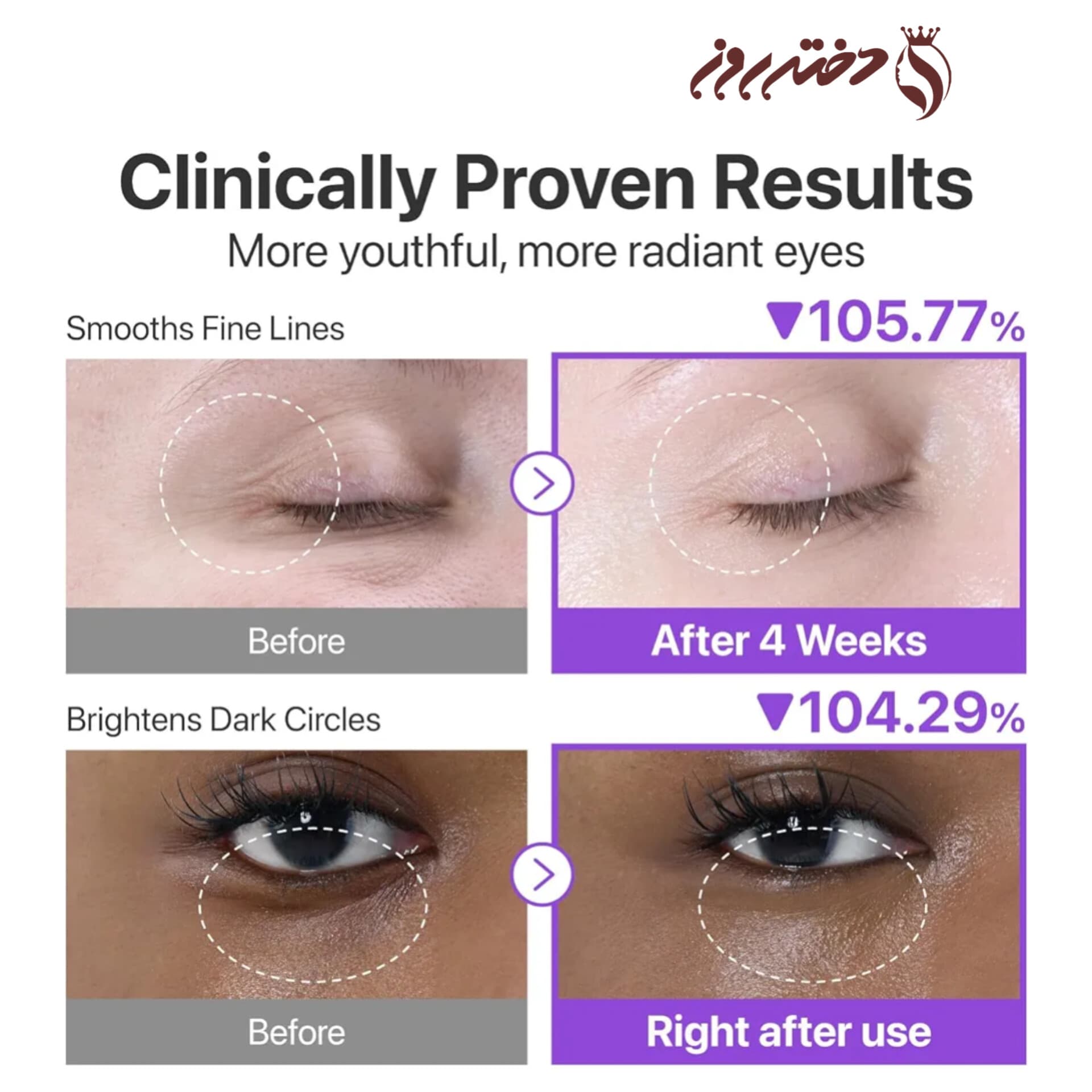 کرم دور چشم لیفتینگ نامبوزین 10 میل |Numbuzin NAD+ Retinol Volumetox Eye Cream — تصویر ۴