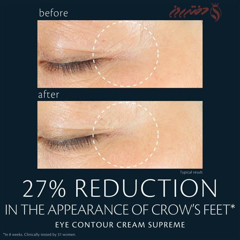 کرم دور چشم کل د پو 15 میل|Clé de Peau Beauté – Eye Contour Cream Supr — تصویر ۷