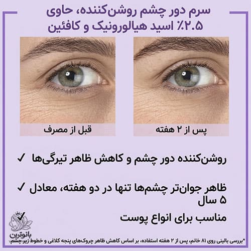 سرم دور چشم رویتالیفت فیلر هیالورونیک اسید و کافئین ضد چروک و روشن کننده لورال — تصویر ۷