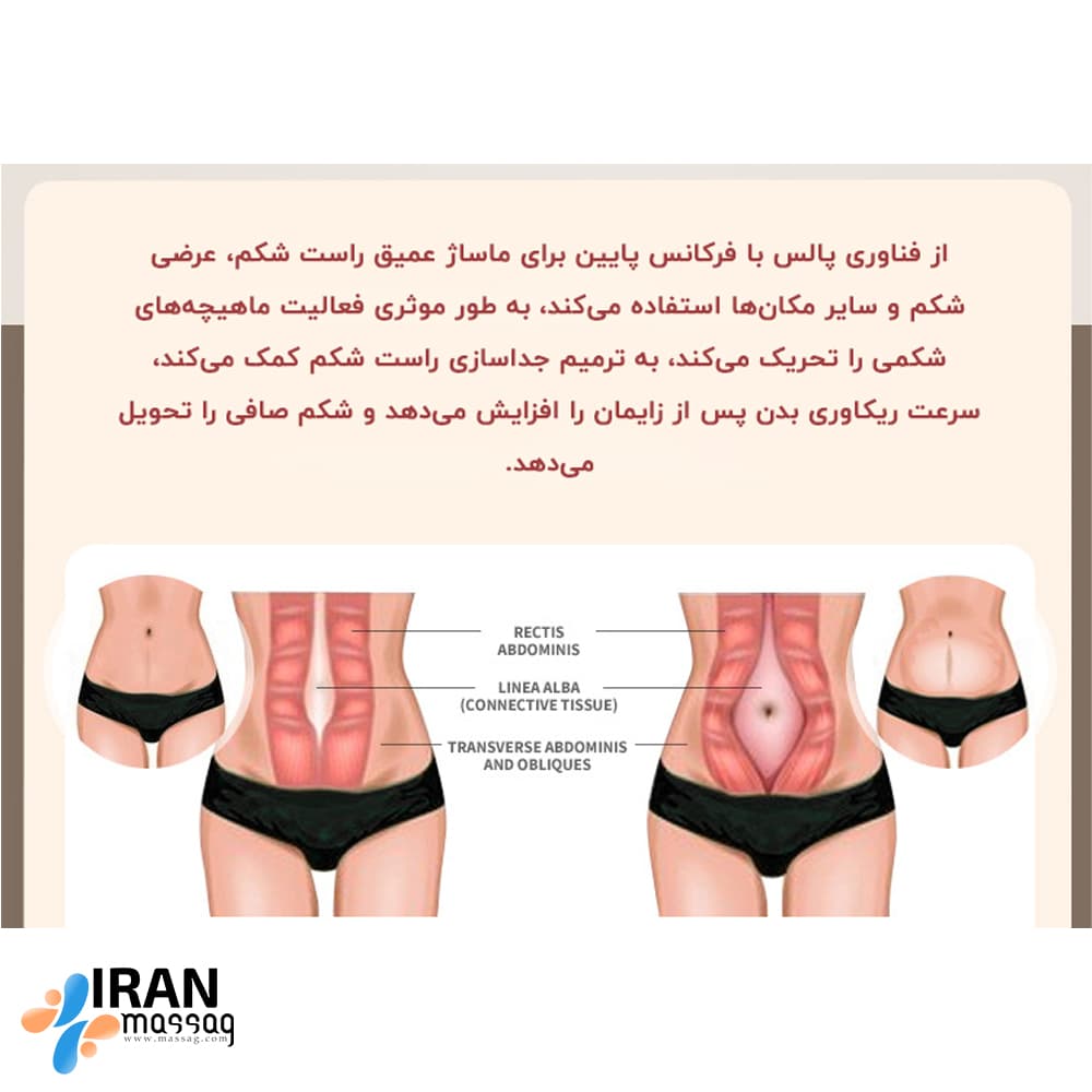 ماساژور تناسب اندام شکم و کمر آیجویر CAX1 | با 6 حالت ماساژ ترکیبی — تصویر ۳