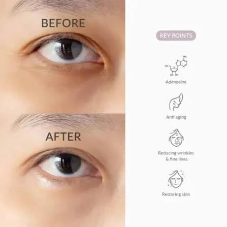سرم دور چشم آبرسان و جوانساز دکتر آلتیا Dr. Althea To Be Youthful Eye Serum حجم 25 میل — تصویر ۲