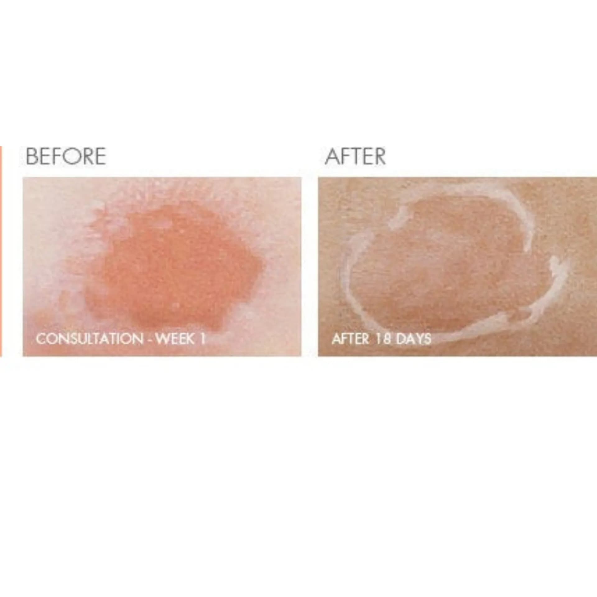 کرم ترمیم کننده اون سیکالفیت پلاس Cicalfate+ حجم 40 میل — تصویر ۵