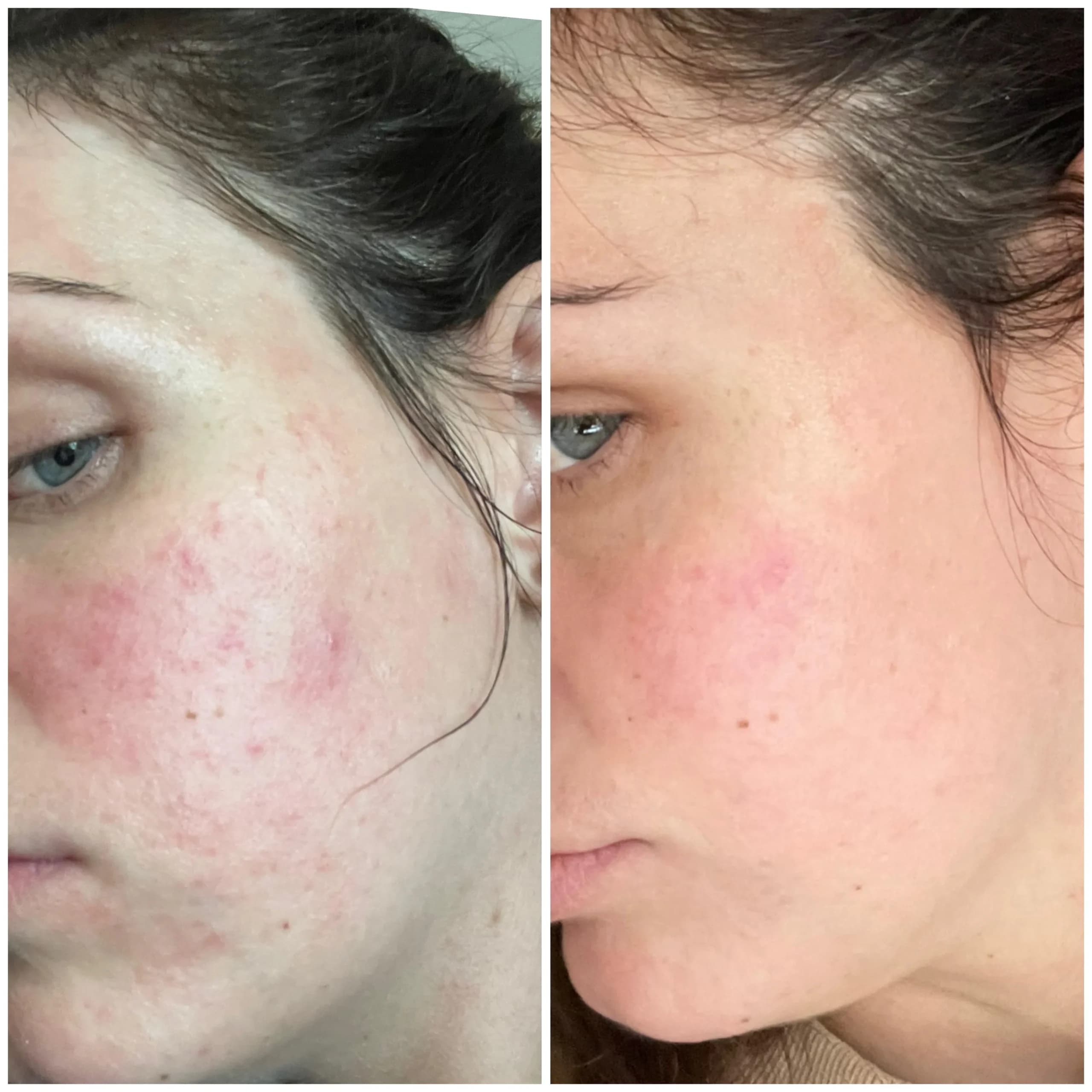 کرم ترمیم کننده اون سیکالفیت پلاس Cicalfate+ حجم 40 میل — تصویر ۶