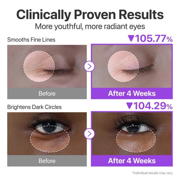 کرم دورچشم لیفتینگ و جوانساز شماره ۹ نامبوزین numbuzin No.9 NAD+ Retinol Volumetox Eye Cream — تصویر ۵