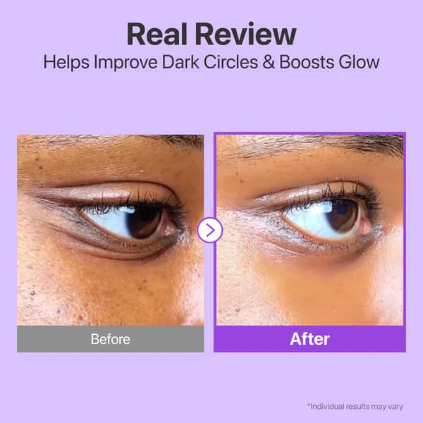 کرم دورچشم لیفتینگ و جوانساز شماره ۹ نامبوزین numbuzin No.9 NAD+ Retinol Volumetox Eye Cream — تصویر ۴