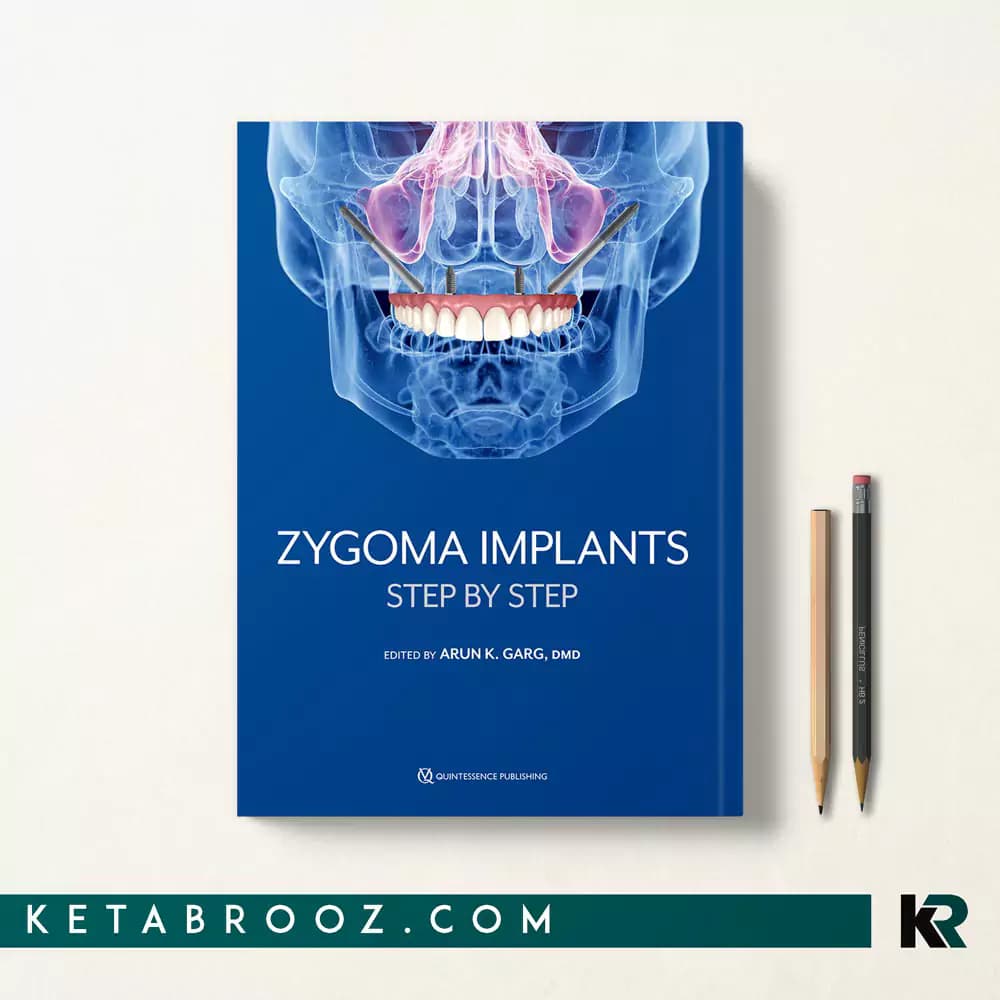 کتاب Zygoma Implants