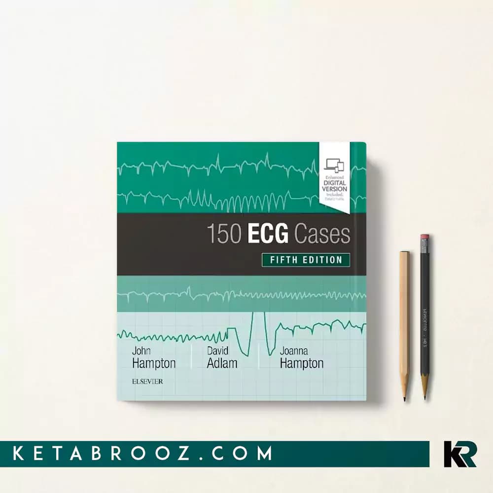 کتاب 150 ECG Cases