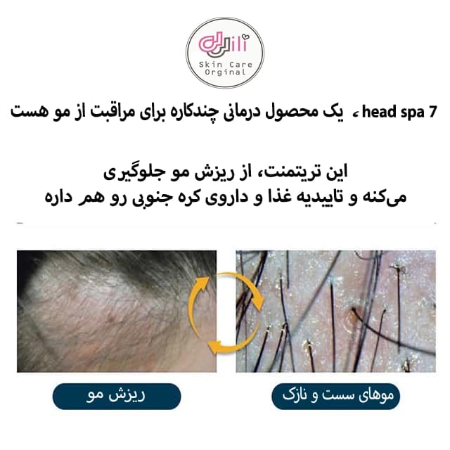 تریتمنت درمانی ریزش موی هد اسپا 7 — تصویر ۷