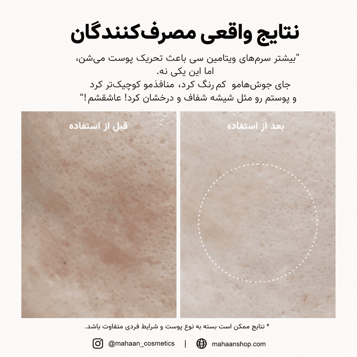 بوستر شات ویتامین سی آرنسیا| روشن‌کننده قوی انواع تیرگی — تصویر ۸