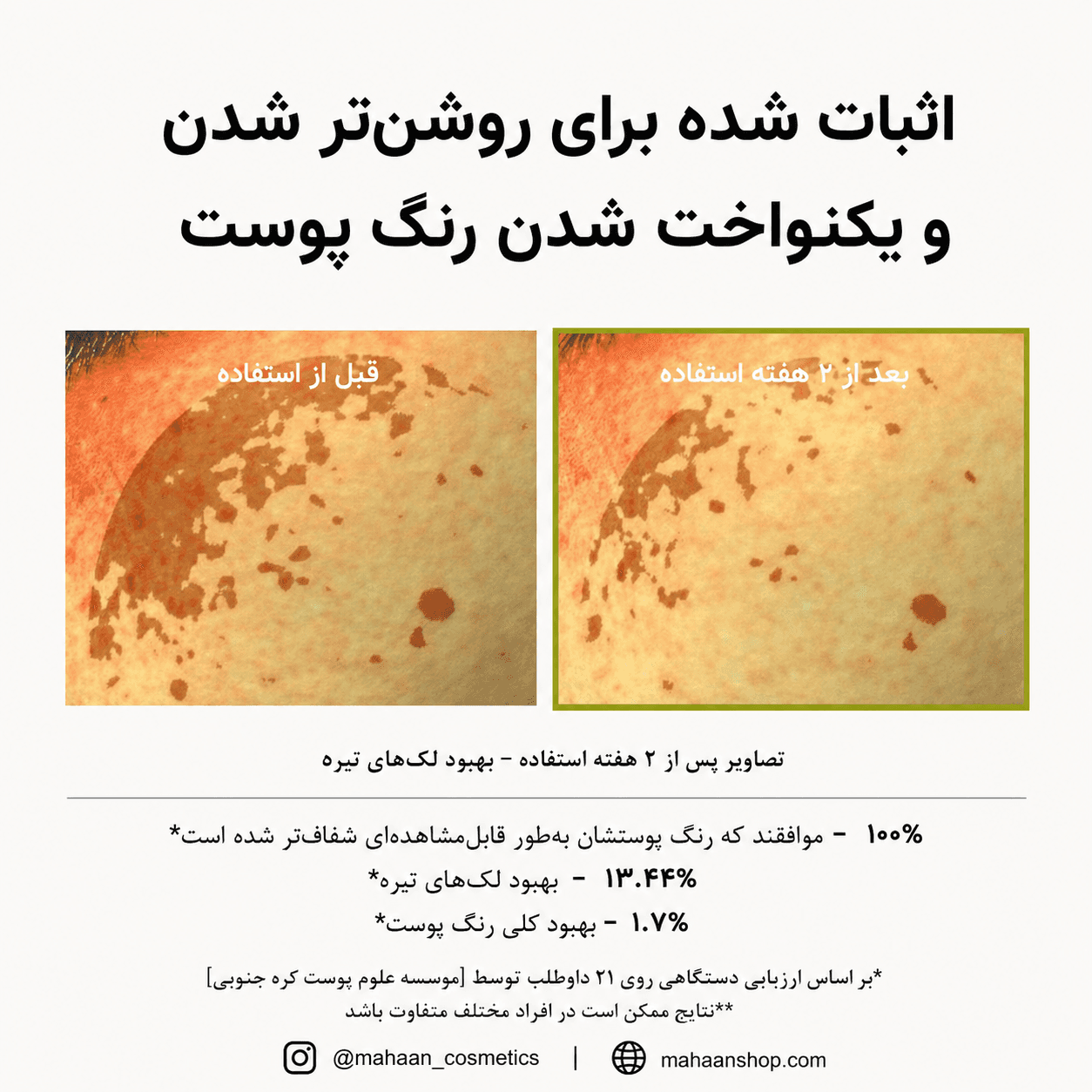 بوستر شات ویتامین سی آرنسیا| روشن‌کننده قوی انواع تیرگی — تصویر ۷