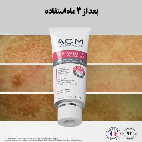ضد لک ای سی ام ACM — تصویر ۲