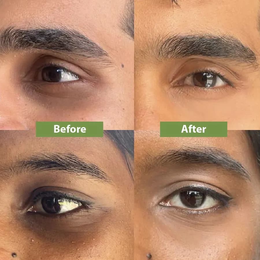 سرم ضد چروک و روشن کننده دور چشم کلاژن اکسیس وای Axis-Y Vegan Collagen Eye Serum 10mil — تصویر ۵