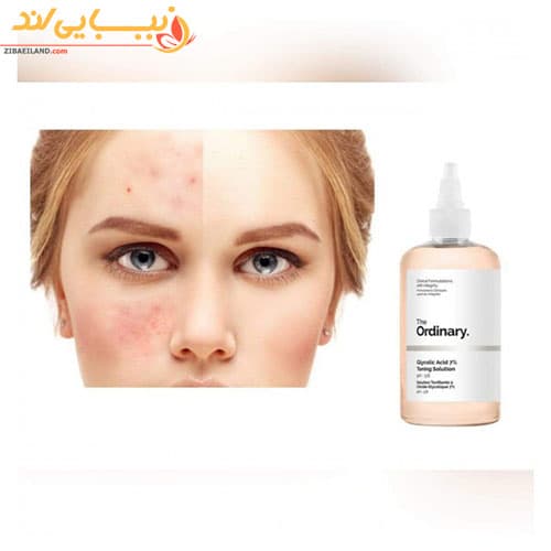 تونر روشن کننده گلیکولیک اسید اوردینری The Ordinary — تصویر ۴