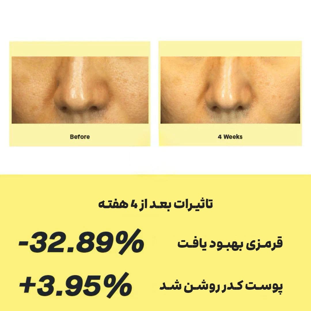 سرم ویتامین سی کوزارکس اصل — تصویر ۳
