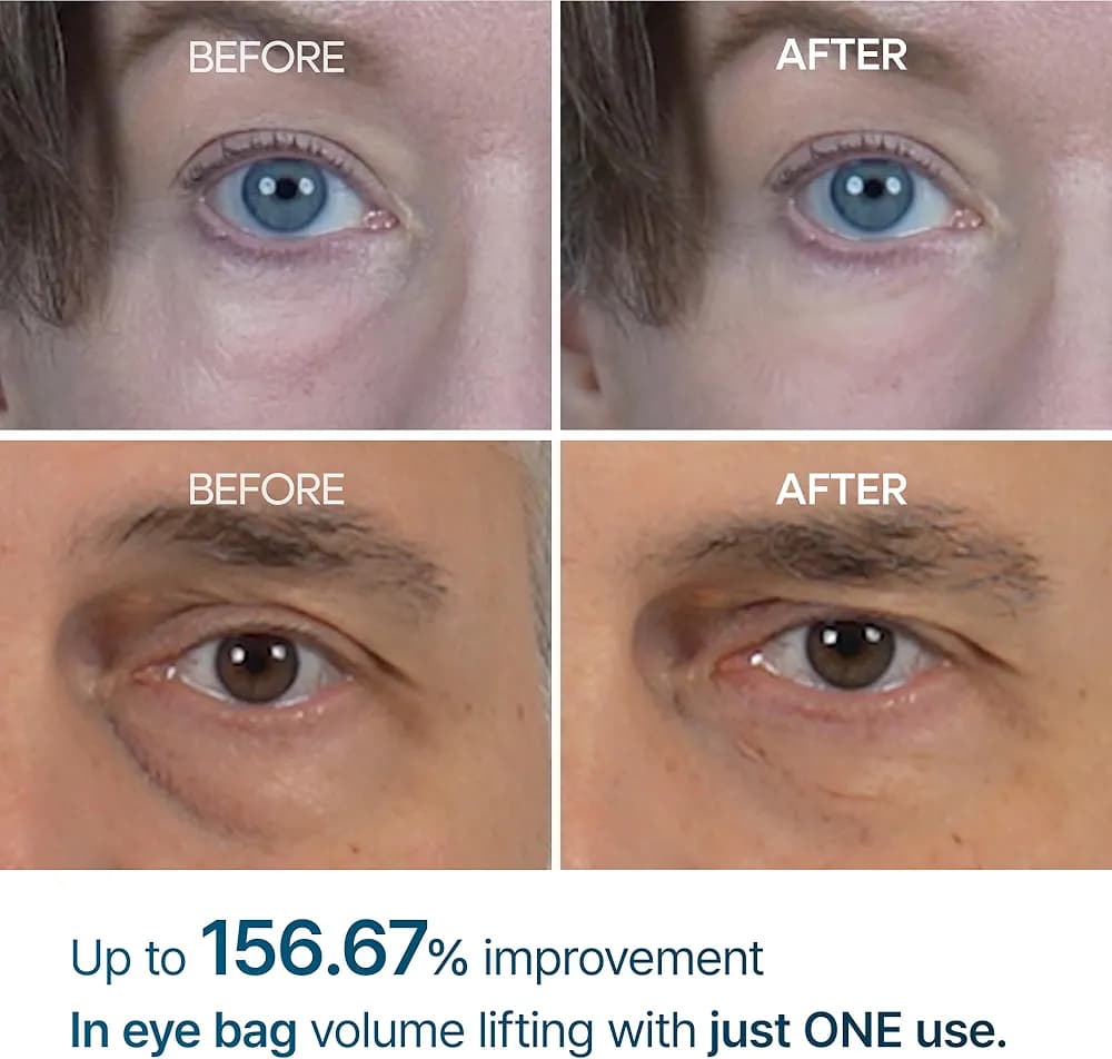 کرم دور چشم ضد پف و تیرگی Dr.Melaxin | Eyephalt Eyebag Cream 10ml — تصویر ۳