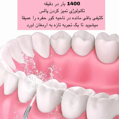 دستگاه 3 حالته شست و شوی قوی دهان و دندان مدل سری A سلامت لثه و دندان — تصویر ۶
