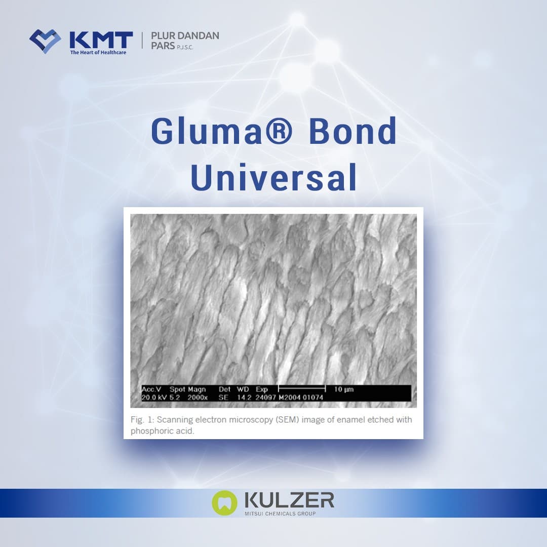 Kulzer Gluma Bond Universal گلوما باند یونیورسال کولزر — تصویر ۳