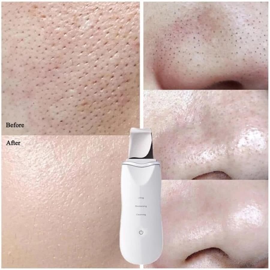 اتو صورت Derma-F مدل 3280 — تصویر ۵