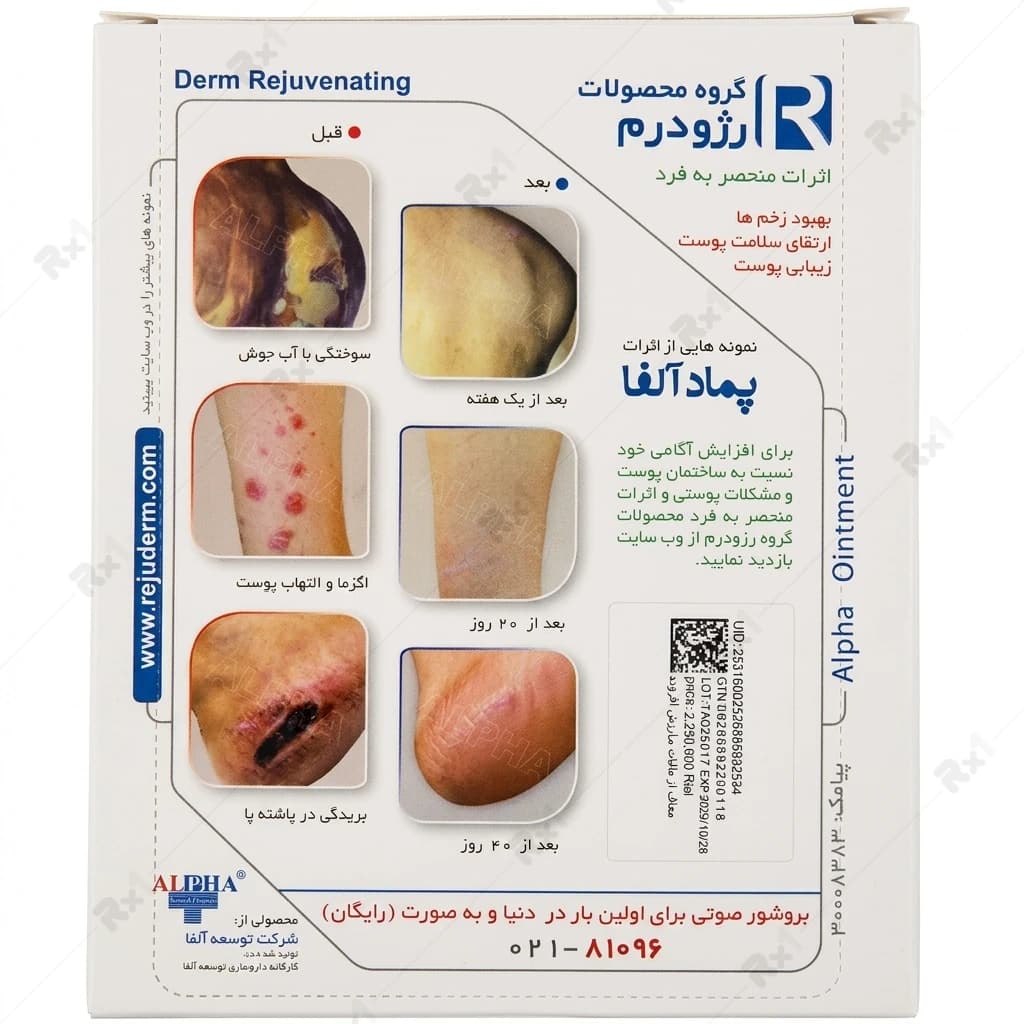 پماد آلفا مناسب سوختگی و التهاب پوست وزن 30 گرم — تصویر ۳