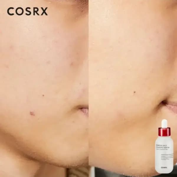 سرم ضد جوش و ضد لک کوزارکس COSRX — تصویر ۷