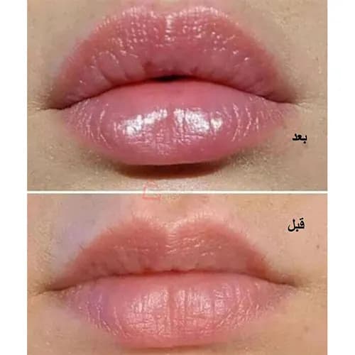 حجم دهنده لب اورجینال مکس مک — تصویر ۶