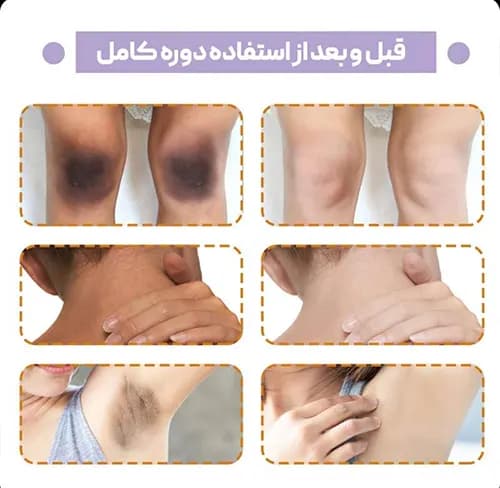 کرم سفید کننده بدن سادور ویتامین سی — تصویر ۷