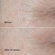 کرم جوانساز و ضد چروک اسمارت کلینیکال ریپیر رینکل کورکتینگ کلینیک حجم 50 میل Clinique Smart Clinical Repair Wrinkle Correcting Cream — تصویر ۳