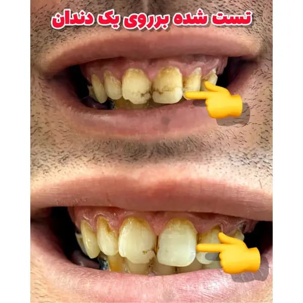 جرمگیر و سفید کننده دندان لاورا (LAVERA) کیفیت تضمینی — تصویر ۲