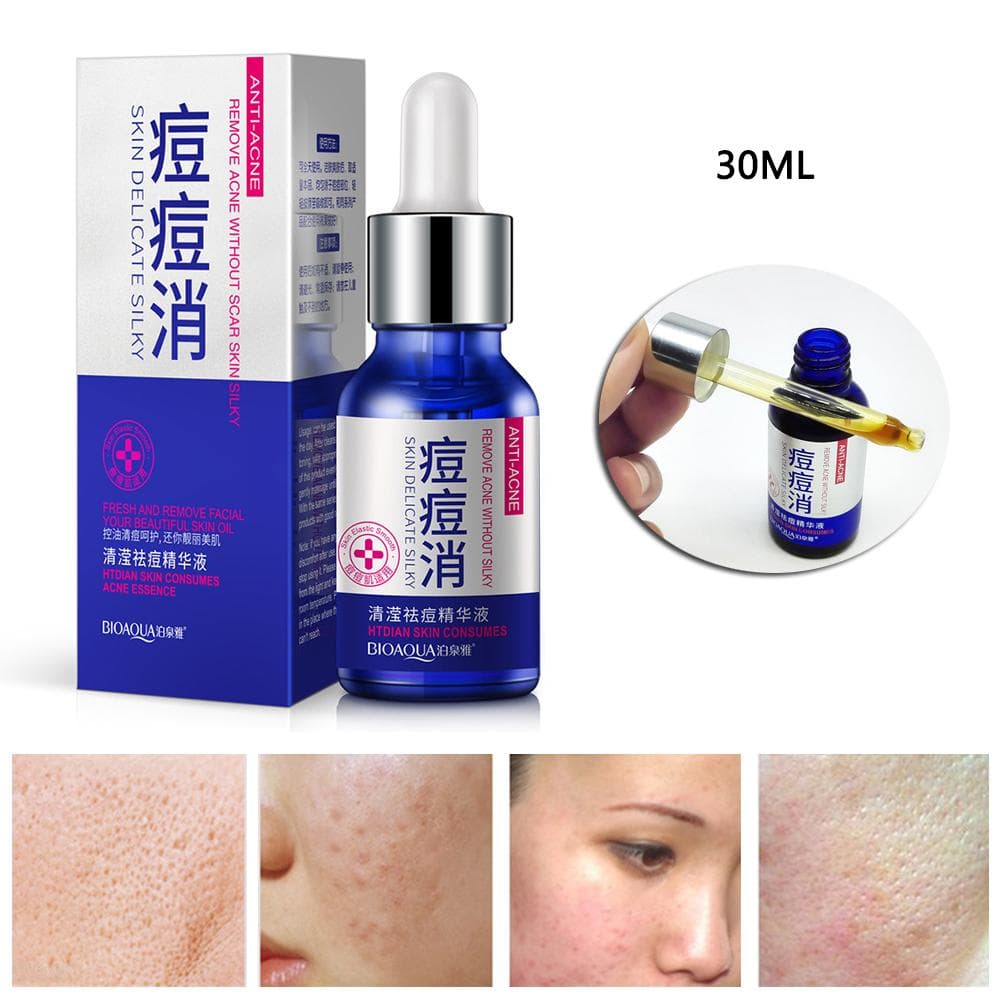 سرم ضدجوش اورژانسی بیوآکوا BIOAQUA — تصویر ۶