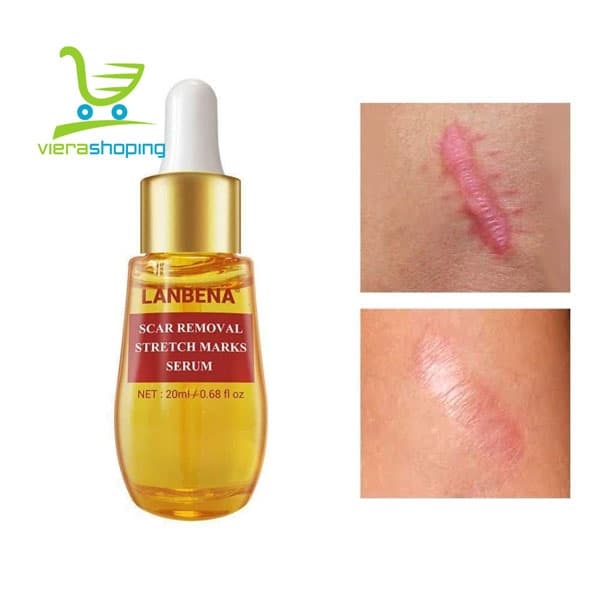 سرم درمان جای جوش و اسکار لانبنا Lanbena Scar Removal