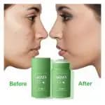 گرین ماسک استیک جادویی لایه بردار – Green Mask — تصویر ۲