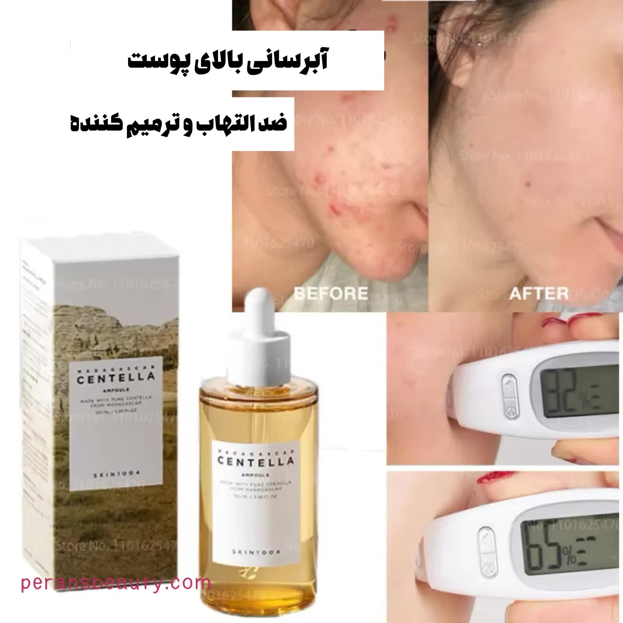 آمپول سنتلا ماداگاسکار اسکین1004 — تصویر ۵
