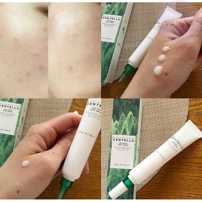 کرم ضد جوش و ضد لک تی تریکا سنتلا اسکین Skin 1004 — تصویر ۲