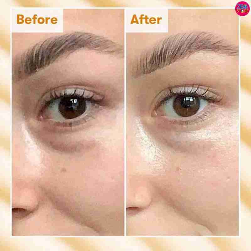 کرم دور چشم حلزون کوزارکس | اصل — تصویر ۵
