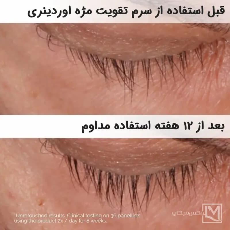 سرم تقویت کننده مژه و ابرو مولتی پپتید لش اوردینری — تصویر ۴