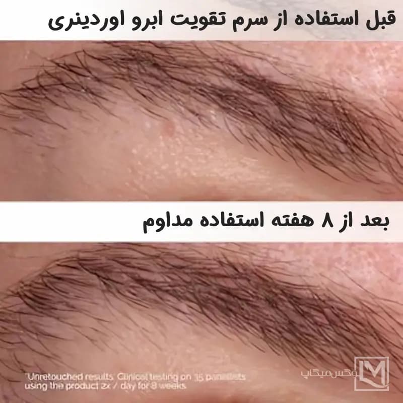 سرم تقویت کننده مژه و ابرو مولتی پپتید لش اوردینری — تصویر ۲