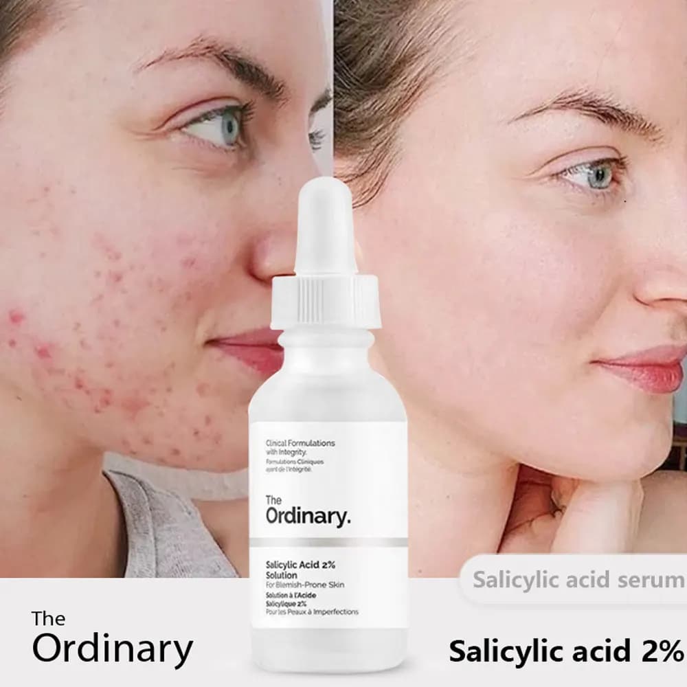 سرم سالیسیلیک اسید اوردینری Ordinary — تصویر ۲