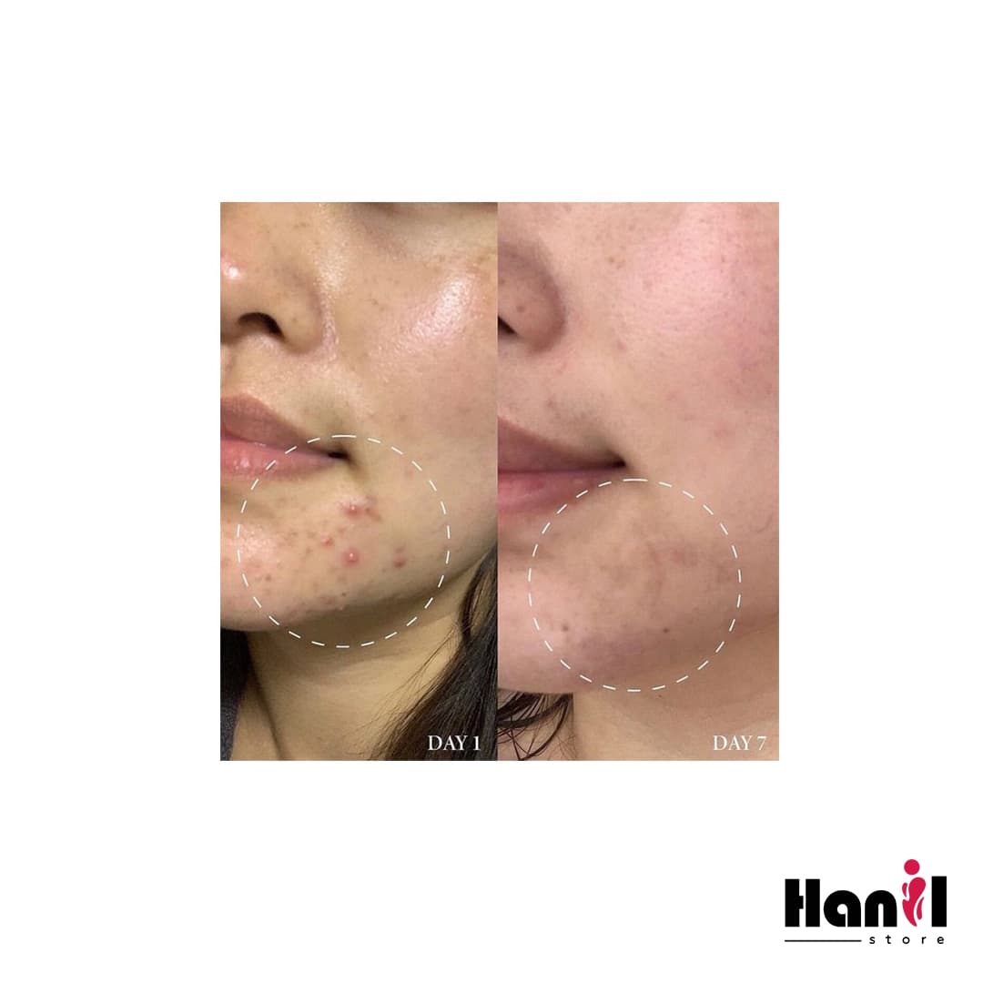 سرم ضد لک و روشن کننده اکسیس وای (Axis-y) حجم 50 میل — تصویر ۴
